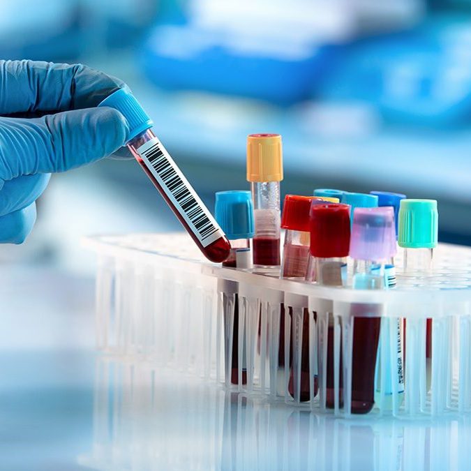 Blood Collection