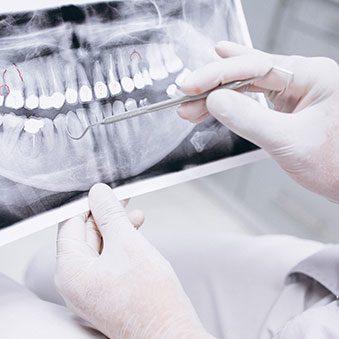Dental